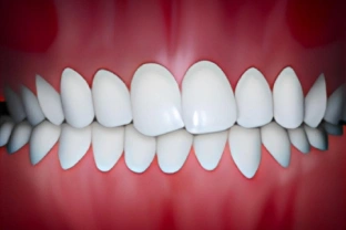 Perfectly aligned white teeth in ideal bite position against red gum background