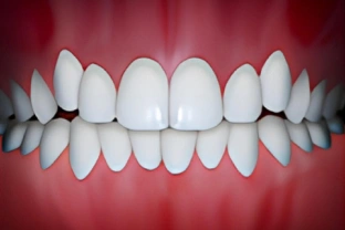 Perfect white teeth alignment displayed in frontal view against red gum background.