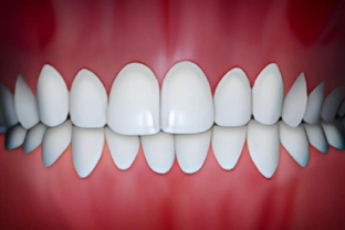 Perfect white teeth alignment shown in frontal view against pink gum background.