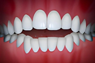 Perfect white teeth aligned in upper and lower rows against red gum background.