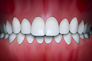 Perfect white teeth alignment display showing ideal orthodontic treatment results and smile outcome.