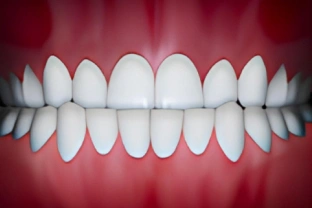 Perfect white teeth alignment shown in dental occlusion view against red background.